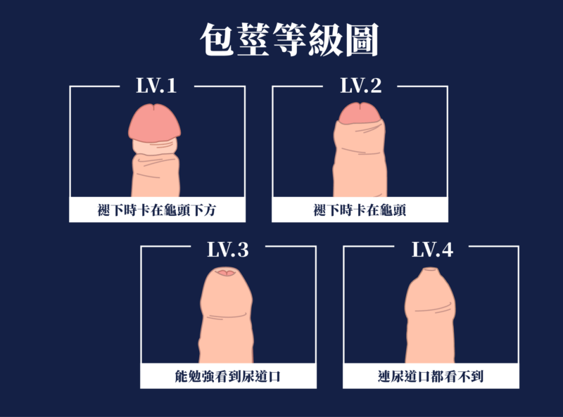 割包皮年紀|包皮槍,台北泌尿科推薦,割包皮健保,恢復,包皮槍保險,費用